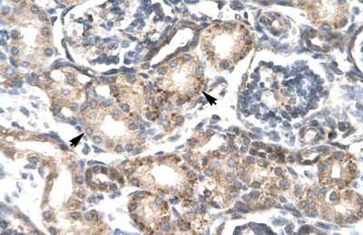 Immunohistochemistry-Paraffin: RGS20 Antibody [NBP1-54885]