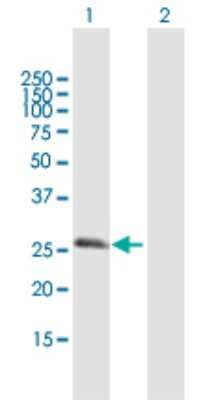 Western Blot: RGS20 Antibody [H00008601-B01P]
