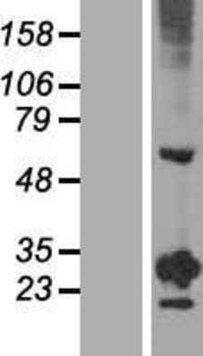 Western Blot: RGS20 Overexpression Lysate [NBL1-15328]