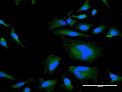 Immunocytochemistry/ Immunofluorescence: RGS21 Antibody [H00431704-B01P]