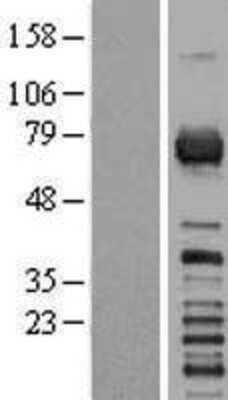 Western Blot: RGS3 Overexpression Lysate [NBL1-15330]