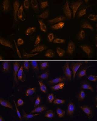 Immunocytochemistry/ Immunofluorescence: RGS4 Antibody - Azide and BSA Free [NBP2-94071]