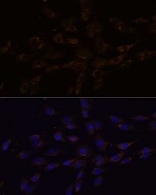 Immunocytochemistry/ Immunofluorescence: RGS4 Antibody - Azide and BSA Free [NBP2-94071]