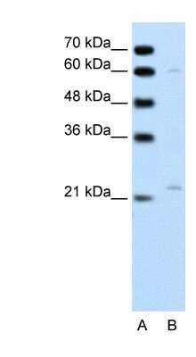 Western Blot: RGS4 Antibody [NBP1-58901]