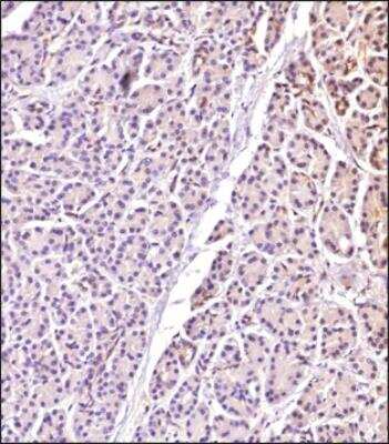 Immunohistochemistry-Paraffin: RGS5 Antibody [NBP2-24945]