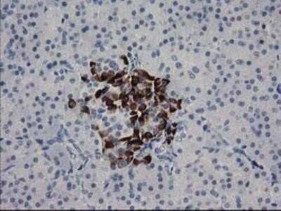 Immunohistochemistry: RGS5 Antibody (OTI1C1) - Azide and BSA Free [NBP2-73887]