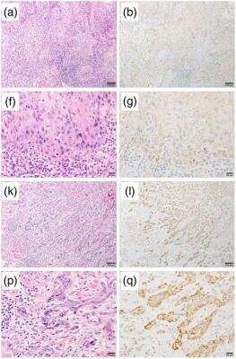 Immunohistochemistry: RGS5 Antibody (OTI1C1) [NBP2-00880]