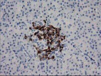 Immunohistochemistry-Paraffin: RGS5 Antibody (OTI1C1) [NBP2-00880]