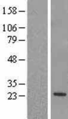 Western Blot: RGS5 Overexpression Lysate [NBL1-15335]