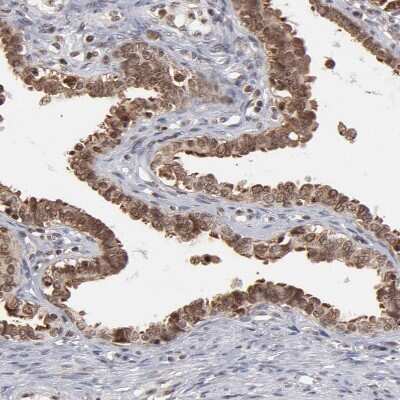 Immunohistochemistry-Paraffin: RGS6 Antibody [NBP1-86524]
