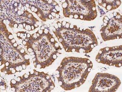 Immunohistochemistry-Paraffin: RGS6 Antibody [NBP3-06581]
