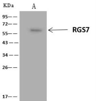 Immunoprecipitation: RGS7 Antibody [NBP3-12720]