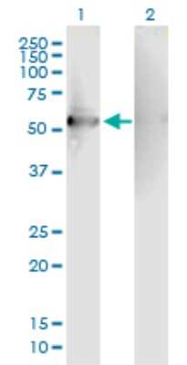 Western Blot: RGS7 Antibody [H00006000-B01P]