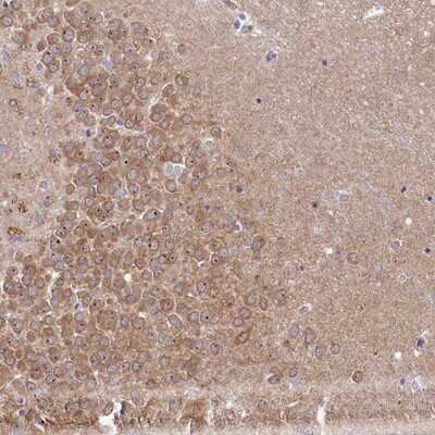 Immunohistochemistry-Paraffin: RGS7BP Antibody [NBP2-14504]