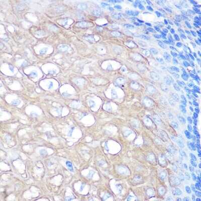 Immunohistochemistry-Paraffin: RHAMM/CD168 Antibody (3L10H9) [NBP3-15424]