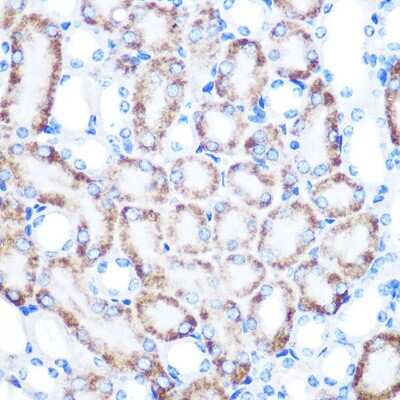 Immunohistochemistry-Paraffin: RHAMM/CD168 Antibody (3L10H9) [NBP3-15424]