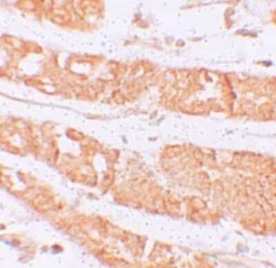 Immunohistochemistry: RHAMM/CD168 Antibody - BSA Free [NBP1-76538]
