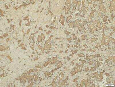 Immunohistochemistry-Paraffin: RHAMM/CD168 Antibody [NBP2-15781]