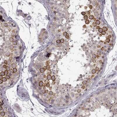 Immunohistochemistry-Paraffin: RHAMM/CD168 Antibody [NBP2-38459]