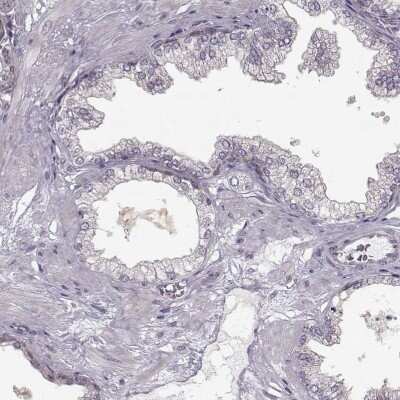 Immunohistochemistry-Paraffin: RHAMM/CD168 Antibody [NBP2-38459]