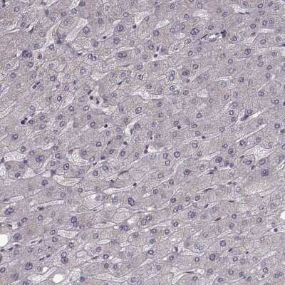 Immunohistochemistry-Paraffin: RHAMM/CD168 Antibody [NBP2-38459]