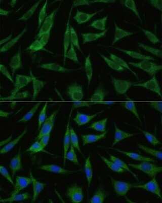 Immunocytochemistry/ Immunofluorescence: RHBDD1 Antibody - Azide and BSA Free [NBP2-93306]