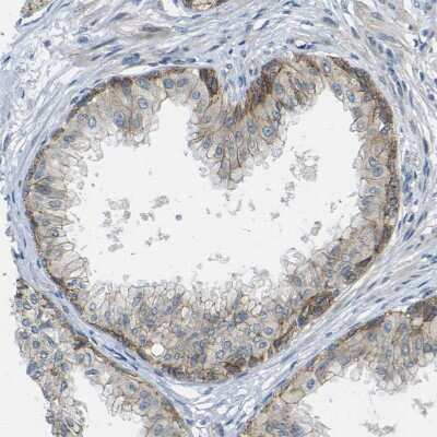 Immunohistochemistry-Paraffin: RHBDD1 Antibody [NBP1-85092]