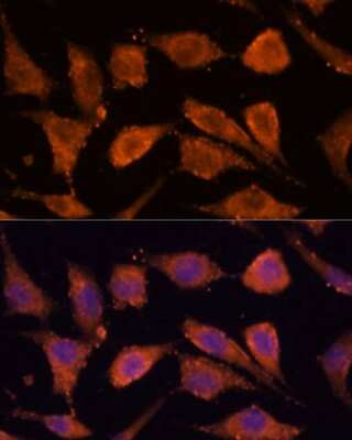 Immunocytochemistry/ Immunofluorescence: RHBDF1 Antibody - Azide and BSA Free [NBP2-94068]