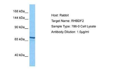 Western Blot: RHBDF2 Antibody [NBP2-84246]