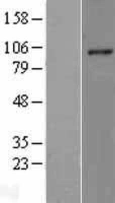 Western Blot: RHBDF2 Overexpression Lysate [NBL1-15344]