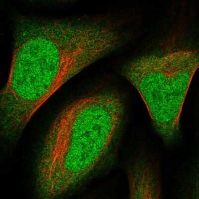 Immunocytochemistry/ Immunofluorescence: RHBDL1 Antibody [NBP2-57512]