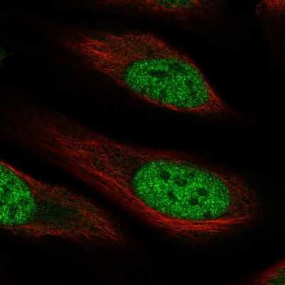 Immunocytochemistry/ Immunofluorescence: RHBDL1 Antibody [NBP2-57513]