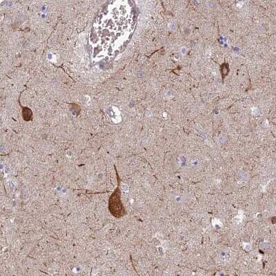Immunohistochemistry-Paraffin: RHBDL2 Antibody [NBP1-92332]