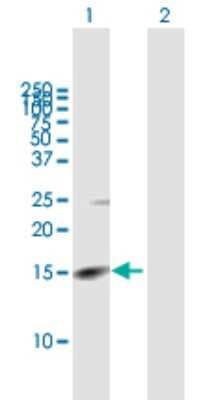 Western Blot: RHBDL2 Antibody [H00054933-B01P]