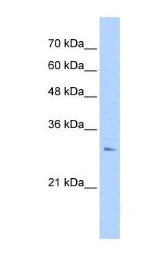 Western Blot: RHBDL2 Antibody [NBP1-59971]