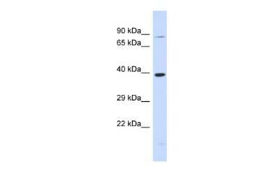 Western Blot: RHBDL2 Antibody [NBP3-09233]
