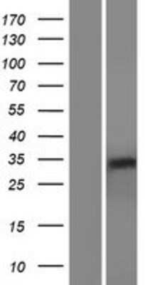 Western Blot: RHBDL2 Overexpression Lysate [NBP2-06916]