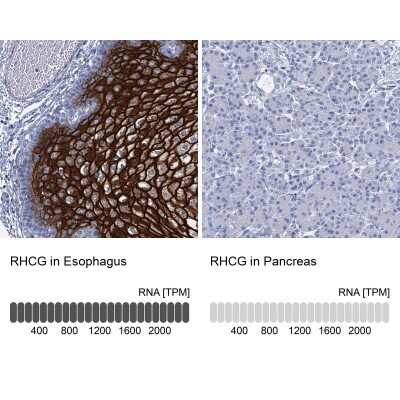 Immunohistochemistry-Paraffin: RHCG Antibody [NBP2-30825]