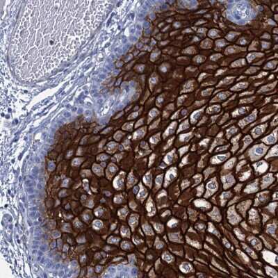 Immunohistochemistry-Paraffin: RHCG Antibody [NBP2-30825]