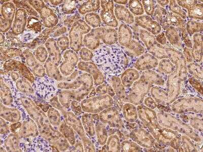 Immunohistochemistry-Paraffin: RHD Antibody [NBP2-99553]
