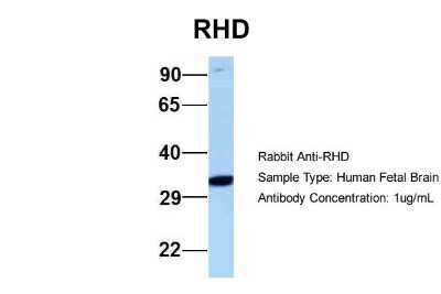 Western Blot: RHD Antibody [NBP2-84247]