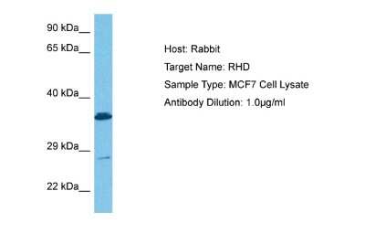 Western Blot: RHD Antibody [NBP2-84248]