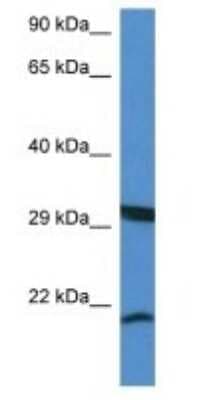 Western Blot: RHEBL1 Antibody [NBP1-74160]