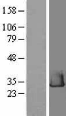 Western Blot: RHEBL1 Overexpression Lysate [NBL1-15347]