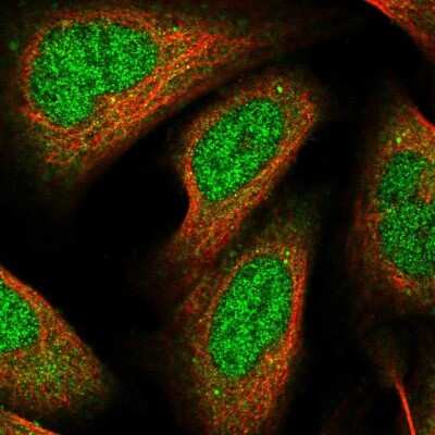 Immunocytochemistry/ Immunofluorescence: RHOBTB1 Antibody [NBP2-55210]