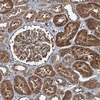 Immunohistochemistry: RHOBTB1 Antibody [NBP1-81485]