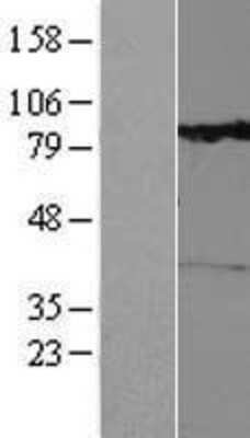 Western Blot: RHOBTB1 Overexpression Lysate [NBL1-15352]