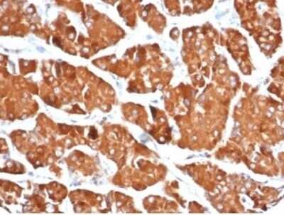 Immunohistochemistry-Paraffin: RHOBTB2 Antibody (DBC2/3361) [NBP3-13899]