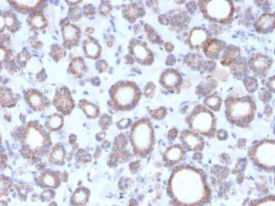 Immunohistochemistry-Paraffin: RHOBTB2 Antibody (DBC2/3364) [NBP3-07485]