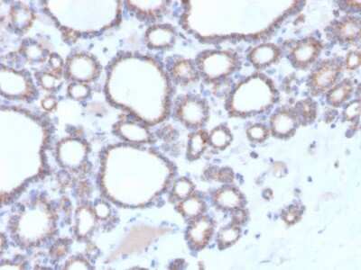 Immunohistochemistry-Paraffin: RHOBTB2 Antibody (DBC2/3364) - Azide and BSA Free [NBP3-08806]
